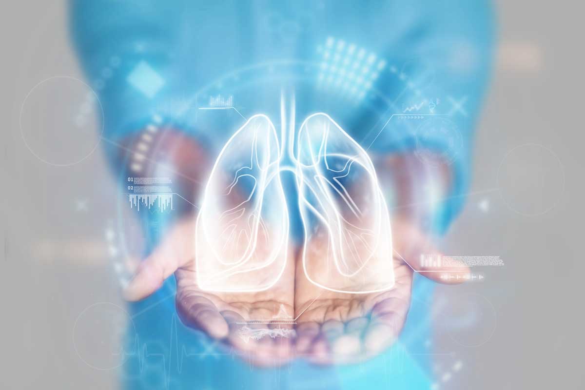 PNEUMOPATIE INFILTRATIVE DIFFUSE: UN APPROCCIO MULTIDISCIPLINARE   FINALIZZATO ALLA CORRETTA DIAGNOSI 
